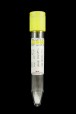 Vacutest<sup>®</sup> 16x100mm Urine Collection Tube, 9.0ml, conical base with preservative